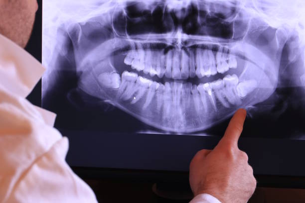 Best Broken Tooth Emergency  in Spencer, OK