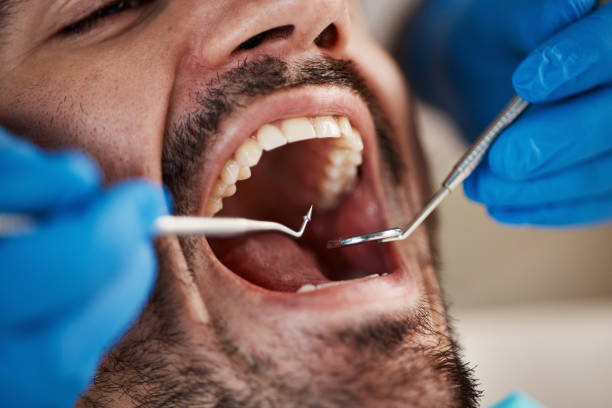 Best Emergency Tooth Extraction  in Spencer, OK
